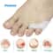 Gel Pinky Toe Separator And Little Toe Protector For Callus Corn And Blister Relief 0