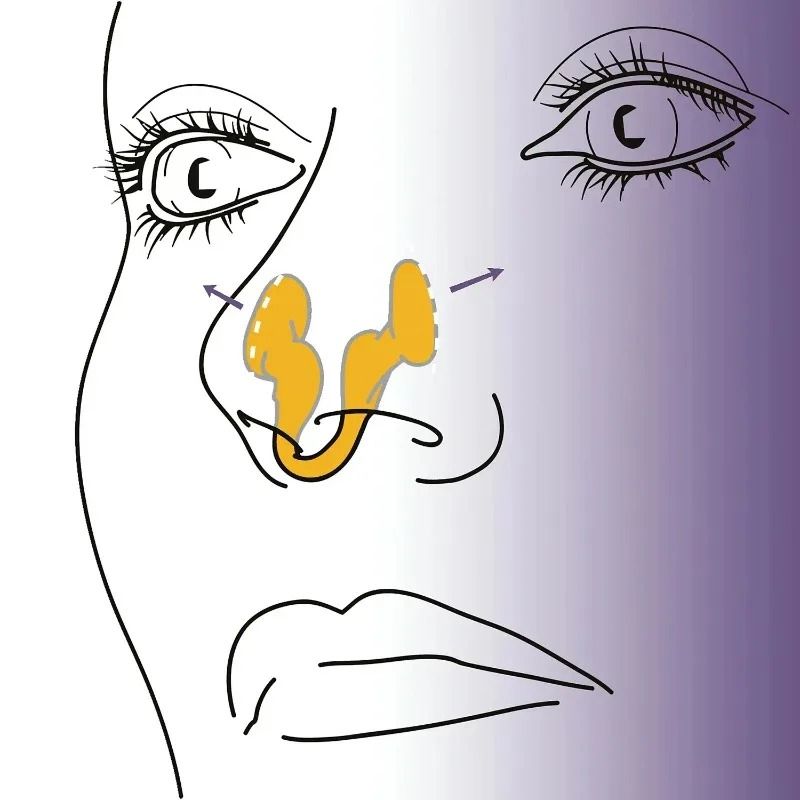 Mini Silicone Nose Clip Anti Snoring Sleep Aid Set 2