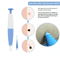 Home skin tag ligation kit demonstration