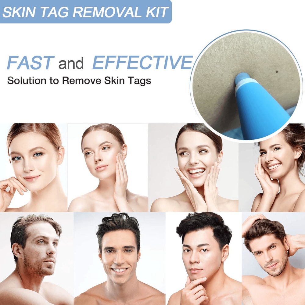 Dermatologygrade skin tag banding tool