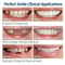 Veneer Snapon Teeth Kit Fake Temporary Tooth Whitening Replacement White Snap Repair Fitting Kit 2