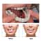 Veneer Snapon Teeth Kit Fake Temporary Tooth Whitening Replacement White Snap Repair Fitting Kit 3