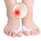 Silicone Toe Separator With Bunion Guard 1
