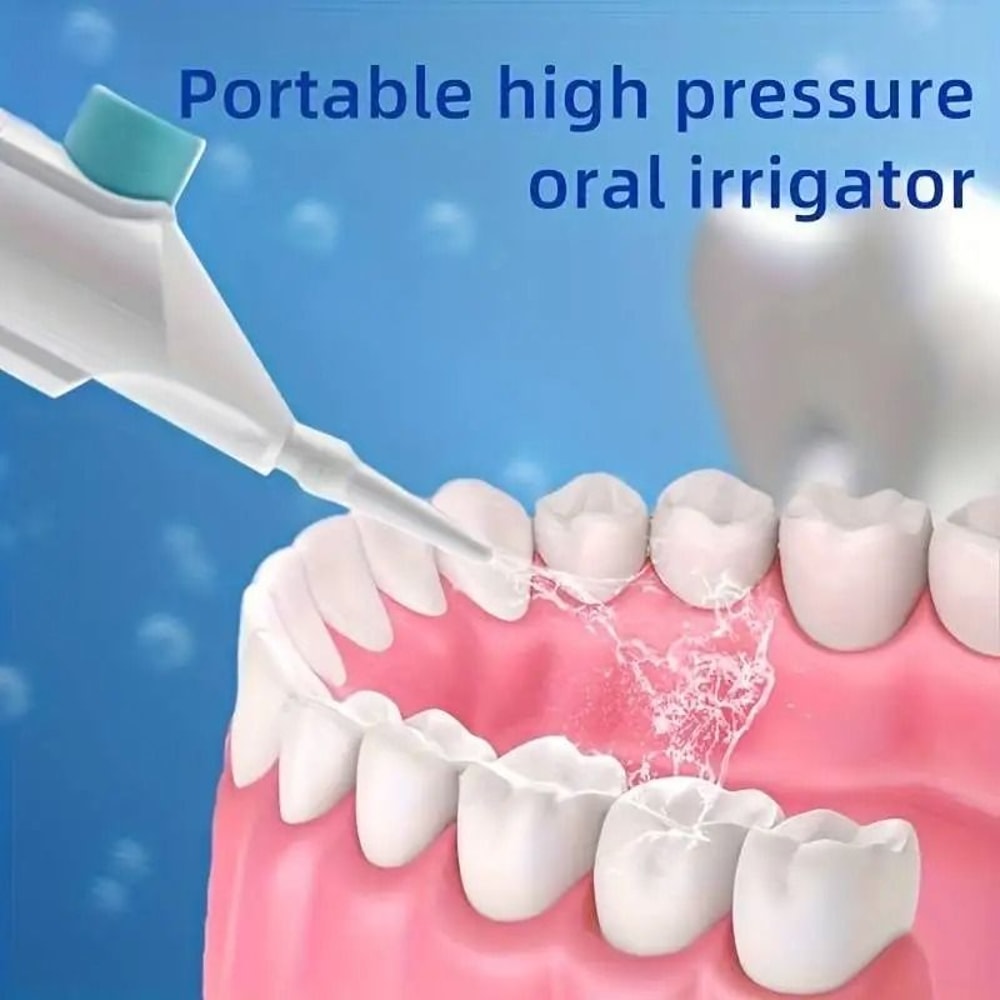Manual HighPressure Portable Oral Irrigator 1