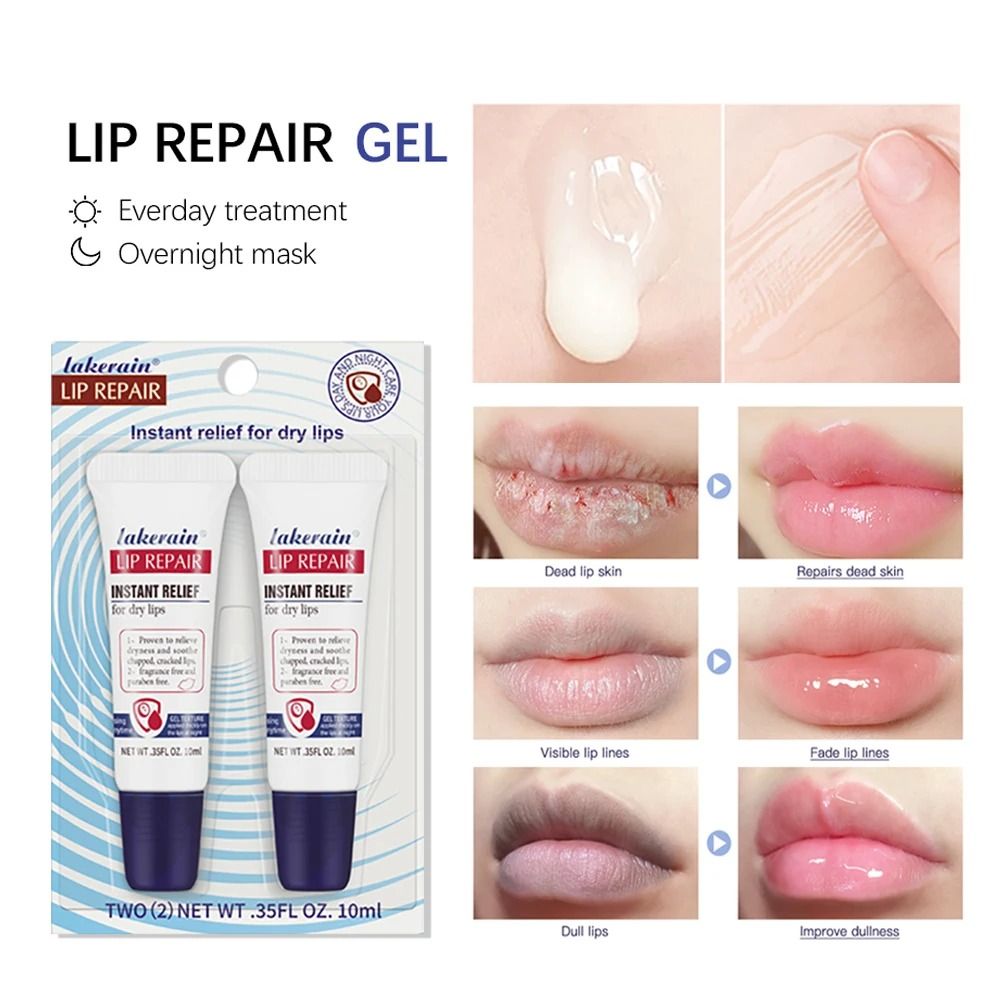 Aquaphor Lip Repair Tubes Moisturizing Balm For Chapped Lips Nutritional Ointment 2Pack 1