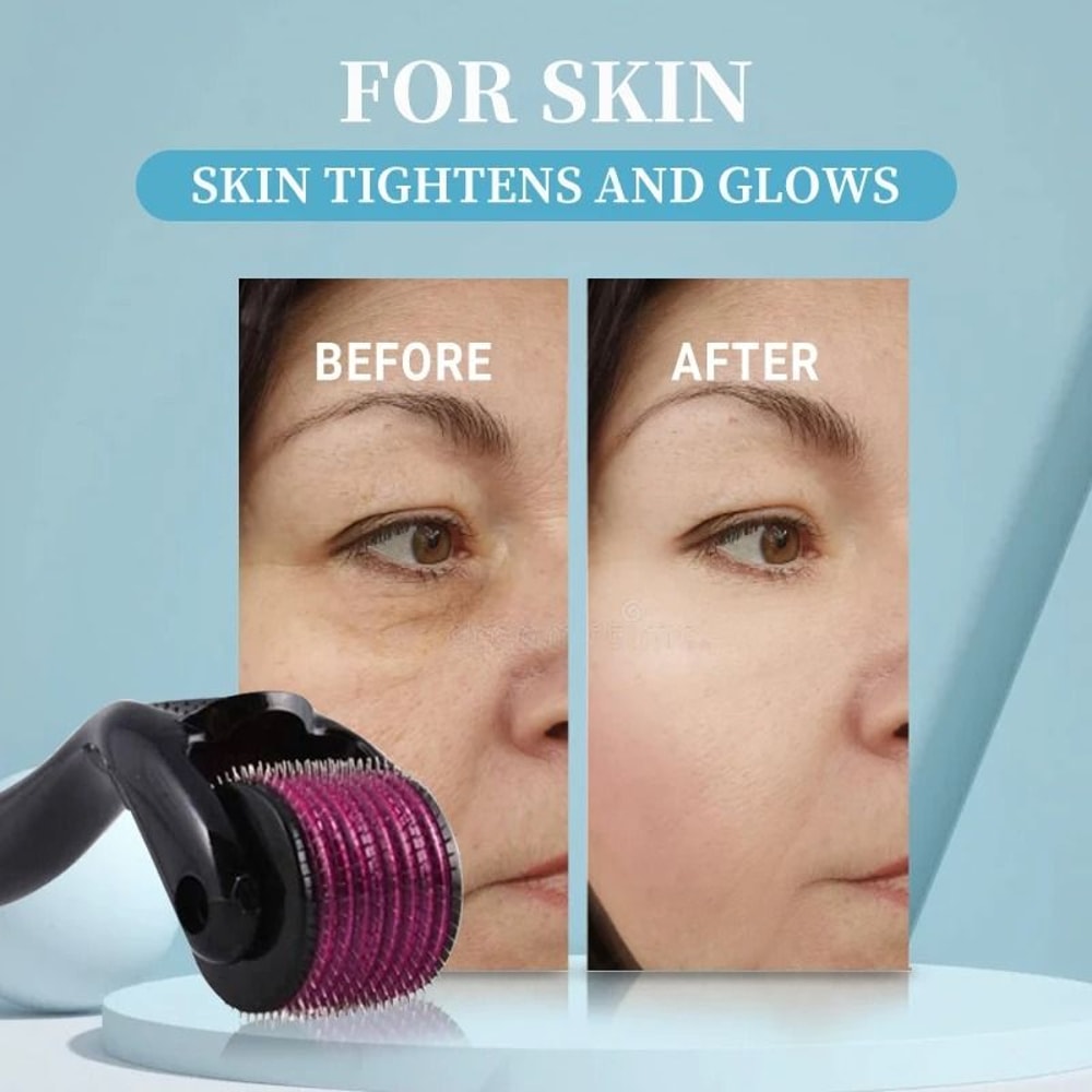 Professional 540 Titanium Derma Roller Hair Beard Regrowth Treatment 3