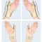 Precision Thumb Spica System Premium Stabilizer Brace For Trigger Thumb Tendonitis 2