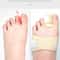 Bunion Corrector And Adjustable Toe Straightener For Hallux Valgus Relief 0