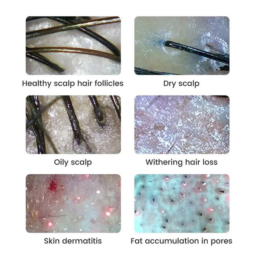 Wireless Digital Skin And Scalp Analyzer With WiFi Connection And High Precision Facial Magnifier M 4