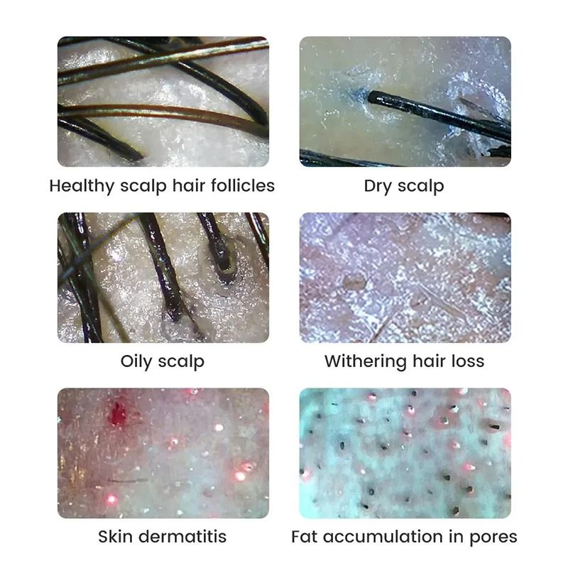 Wireless Digital Skin And Scalp Analyzer With WiFi Connection And High Precision Facial Magnifier M 4