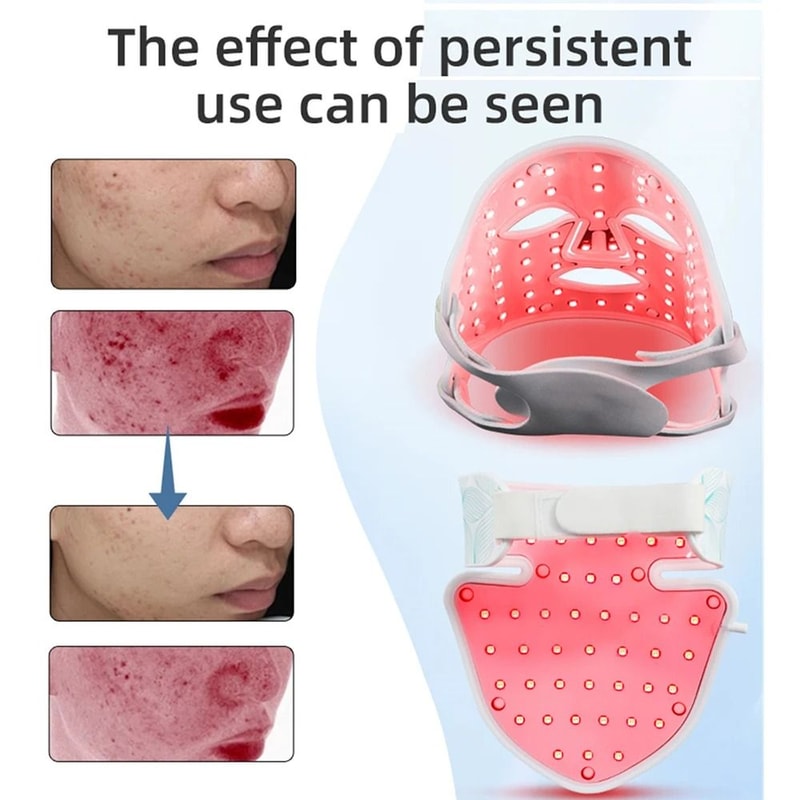 Eight Color LED Facial And Neck Mask With Light Therapy For Skin Firming Whitening And Oil Control 2