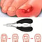 Professional Ingrown Toenail Clipper Set With Stainless Steel Tools 2