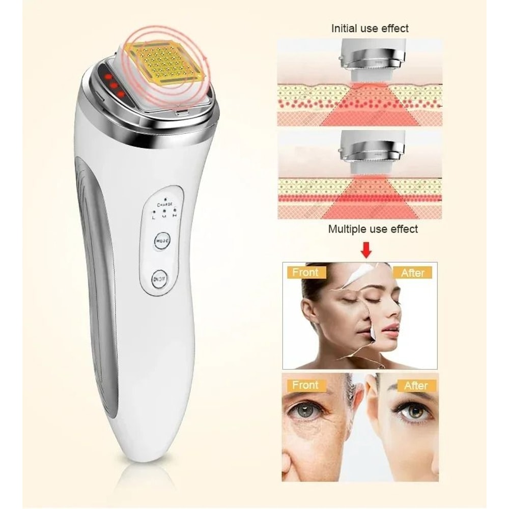 RF Radio Frequency Face Lifting Device Skin Tightening Beauty Massager 3