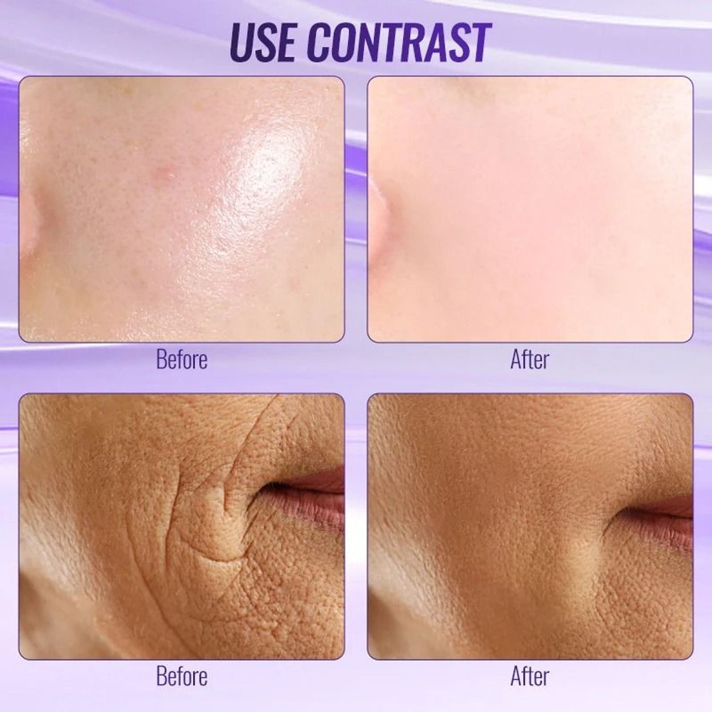 Professional High Frequency Facial Wand 6 In 1 1