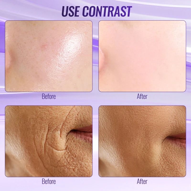 Professional High Frequency Facial Wand 6 In 1 1