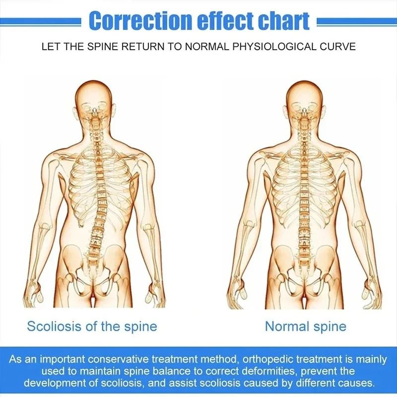 Fixed Spinal Support Brace For Children And Adults With Breathable Aluminum Alloy Design 4