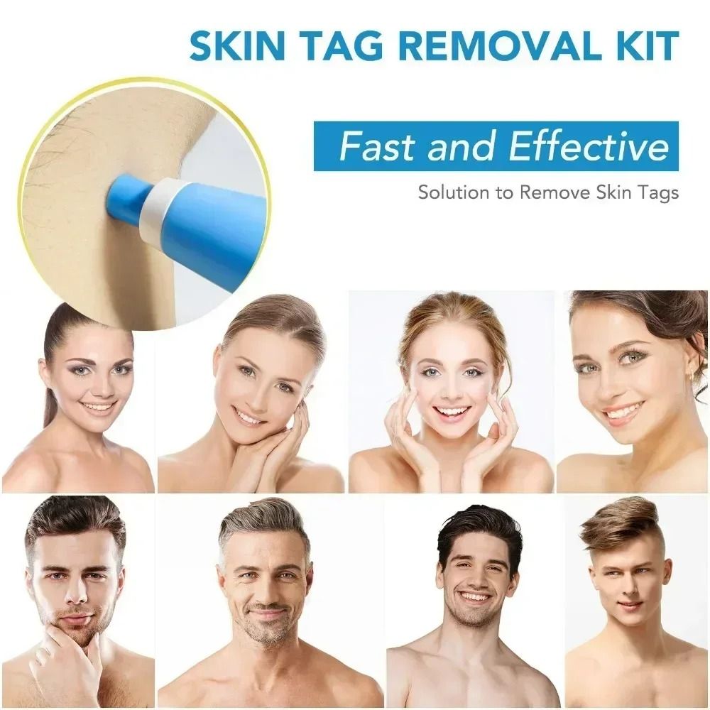 2in1 Skin Tag And Mole Removal Tool Kit 2