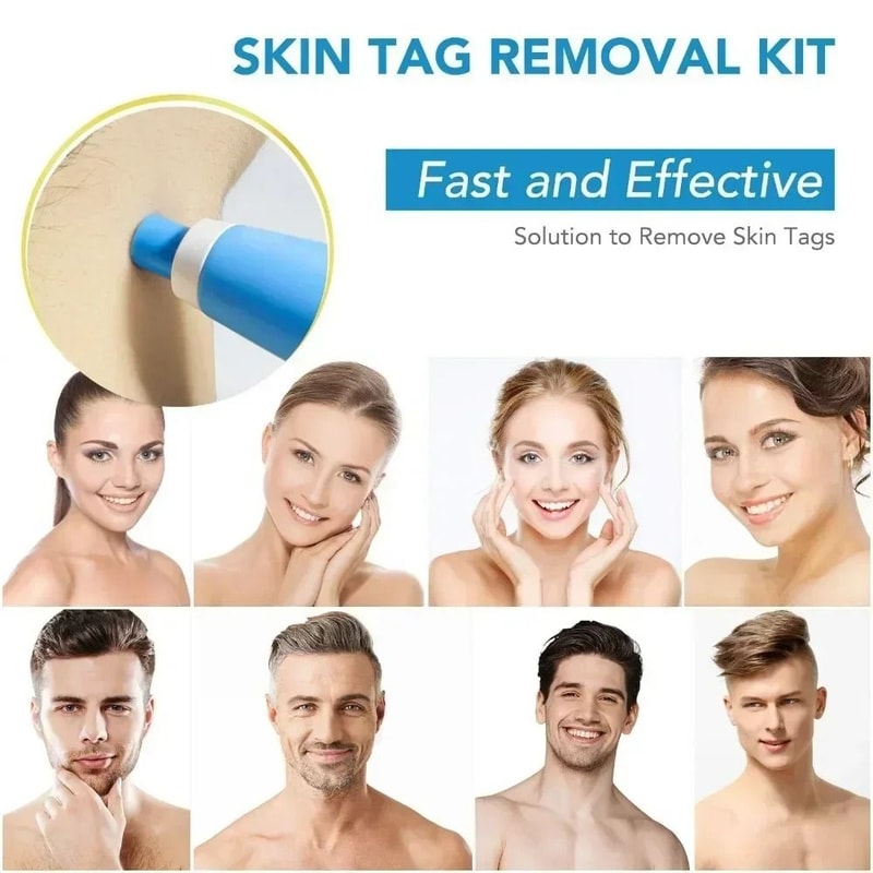 2in1 Skin Tag And Mole Removal Tool Kit 2