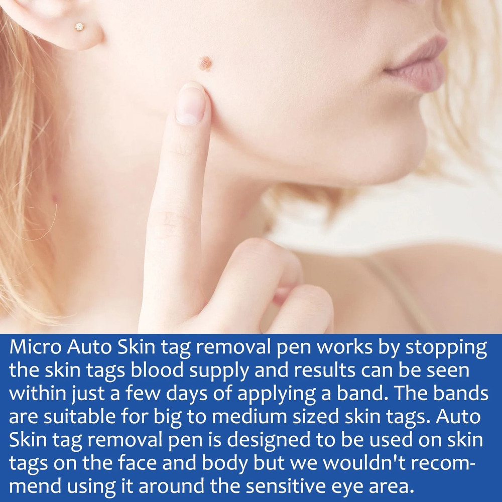 2 In 1 Painless Skin Tag And Mole Removal Kit For Clearer Skin 1