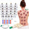 Vacuum Cupping Therapy Set For Muscle Relaxation And Circulation 0