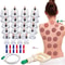 Vacuum Cupping Therapy Set For Muscle Relaxation And Circulation 0