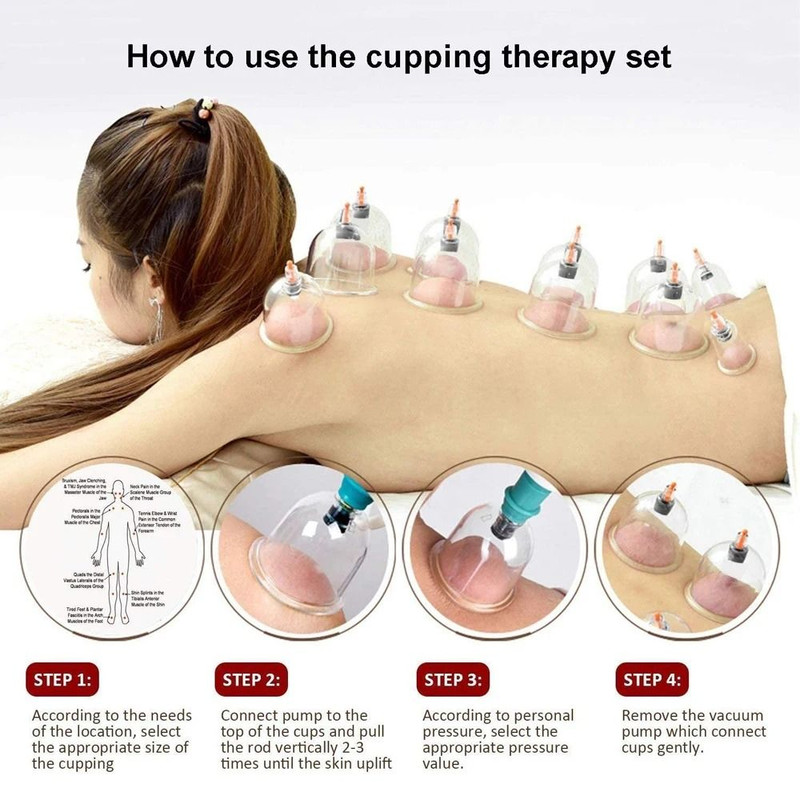 Vacuum Cupping Therapy Set For Muscle Relaxation And Circulation 1