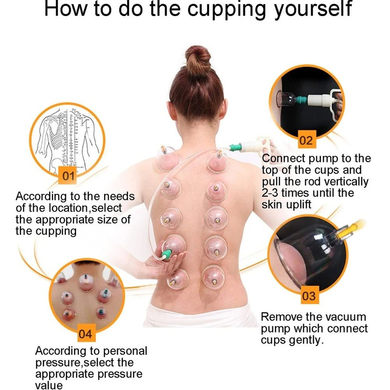 Vacuum Cupping Therapy Set For Muscle Relaxation And Circulation 2