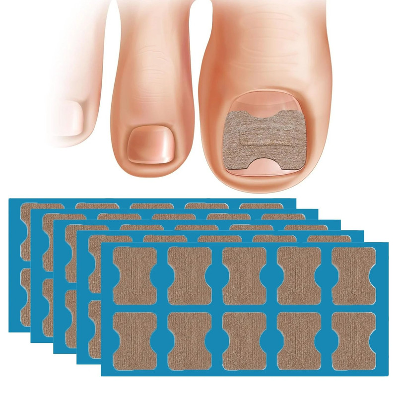 50 And 100 Pcs Nail Correction Stickers For Ingrown Toenail Care 0