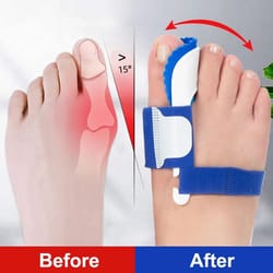 gentle align bunion corrector brace for toe realignment