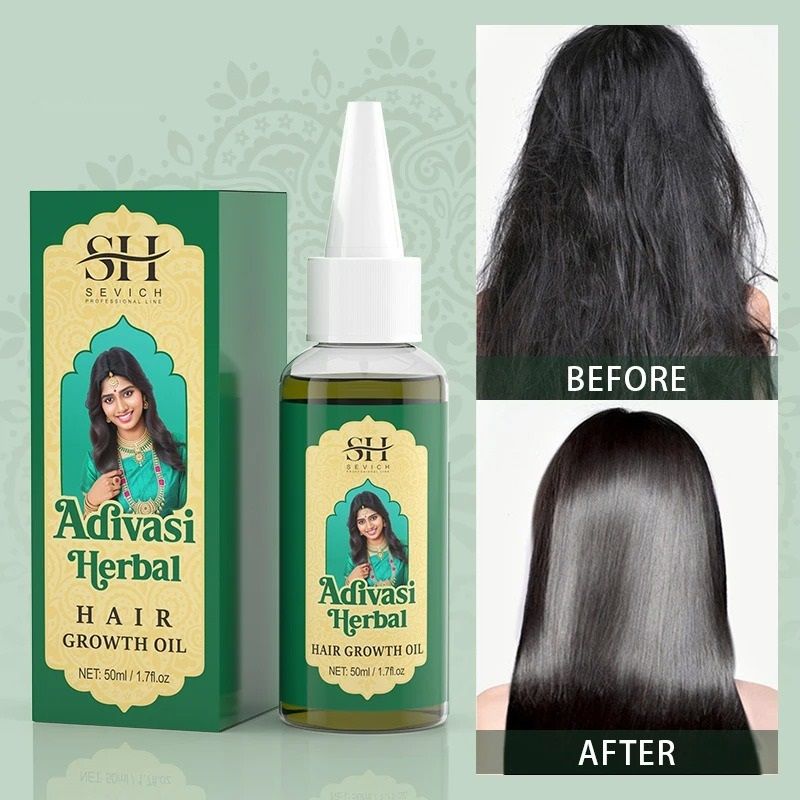 Herbal Hair Growth Oil For Thicker Fuller Stronger Hair 1