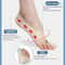 Adjustable Toe Thumb Valgus Corrector With Lightweight Support And Toe Separation 3
