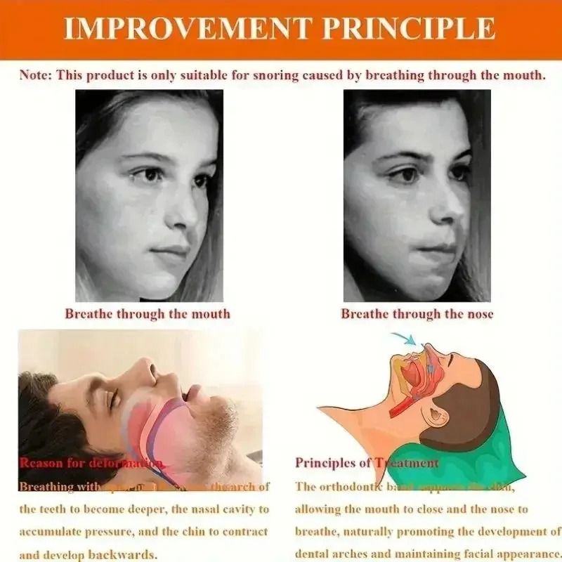 Comfortable Anti Snoring Chin Strap For Open Mouth Sleep Correction 4