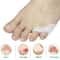 Gel Pinky Toe Separator And Protector Set 0