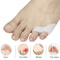 Gel Pinky Toe Separator And Protector Set 0