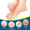 Soft Gel Big Toe Relief Corrector Set 3