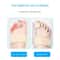 Adjustable Hammer Toe Straightener And Foot Support Wrap 1