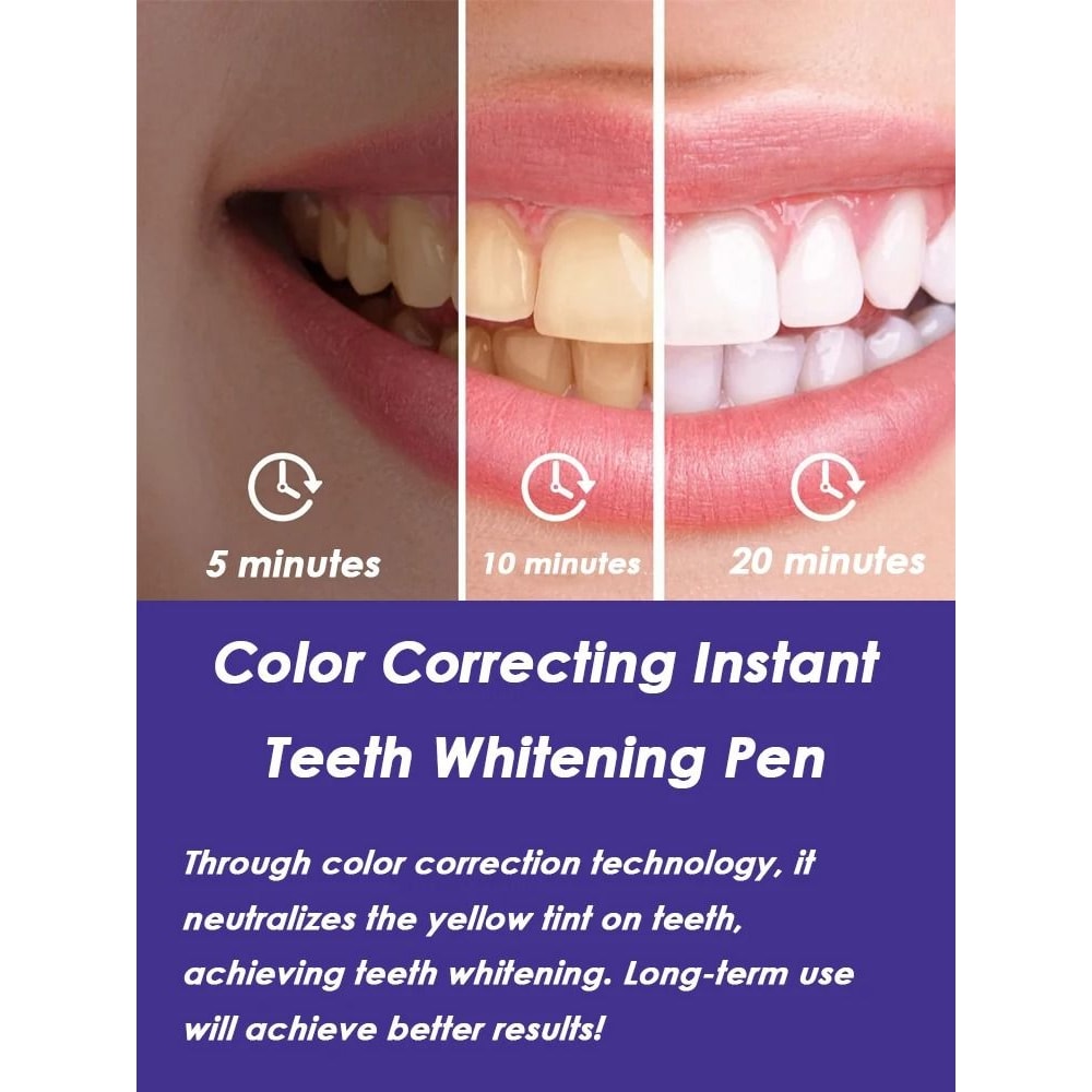 Purple Precision Color Correcting Teeth Whitening Pen 1