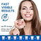Professional Advanced Enamel Safe Teeth Whitening Strips 2