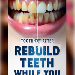 color correcting advanced teeth whitening foam