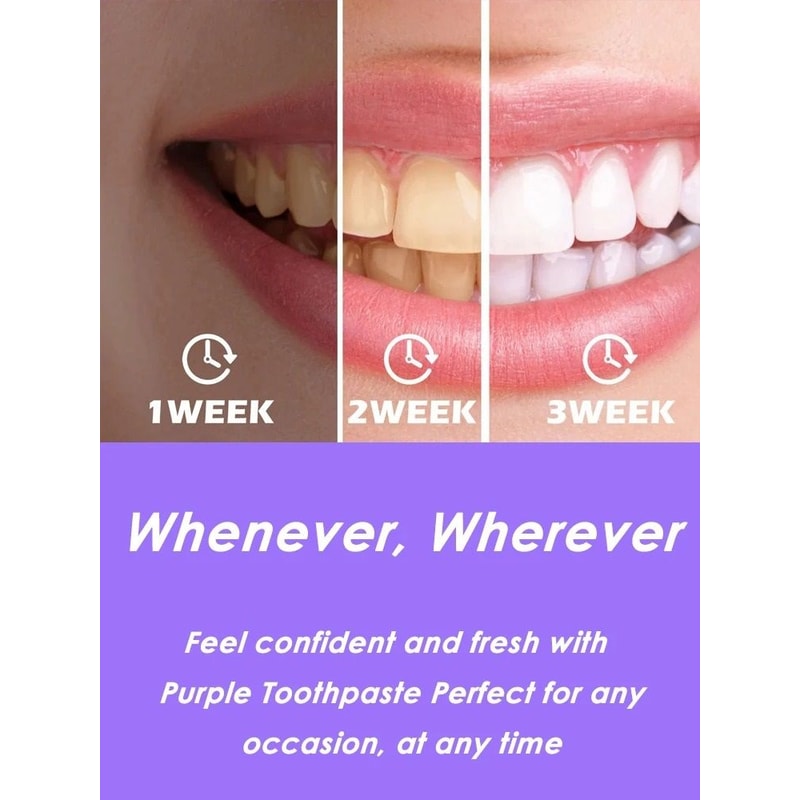 Color Correcting Advanced Teeth Whitening Foam 4