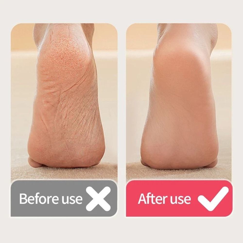 USB Powered Rechargeable Electric Foot Grinder And Callus Remover 2