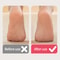 USB Powered Rechargeable Electric Foot Grinder And Callus Remover 2