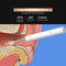 Smart Visual Ear Wax Removal Tool 1