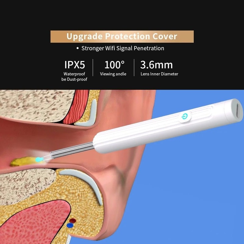 Smart Visual Ear Wax Removal Tool 1