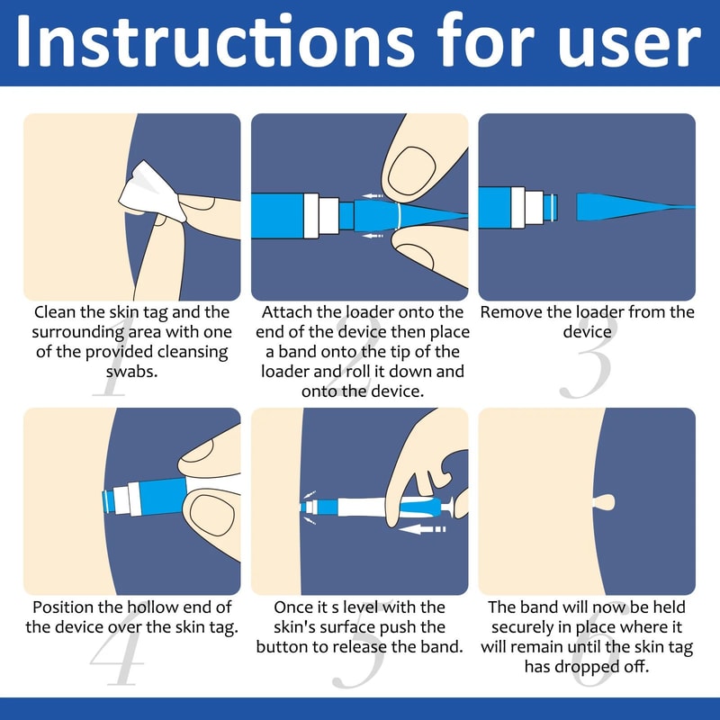 2in1 Skin Tag Removal Tool Kit With Cleansing Swabs 2