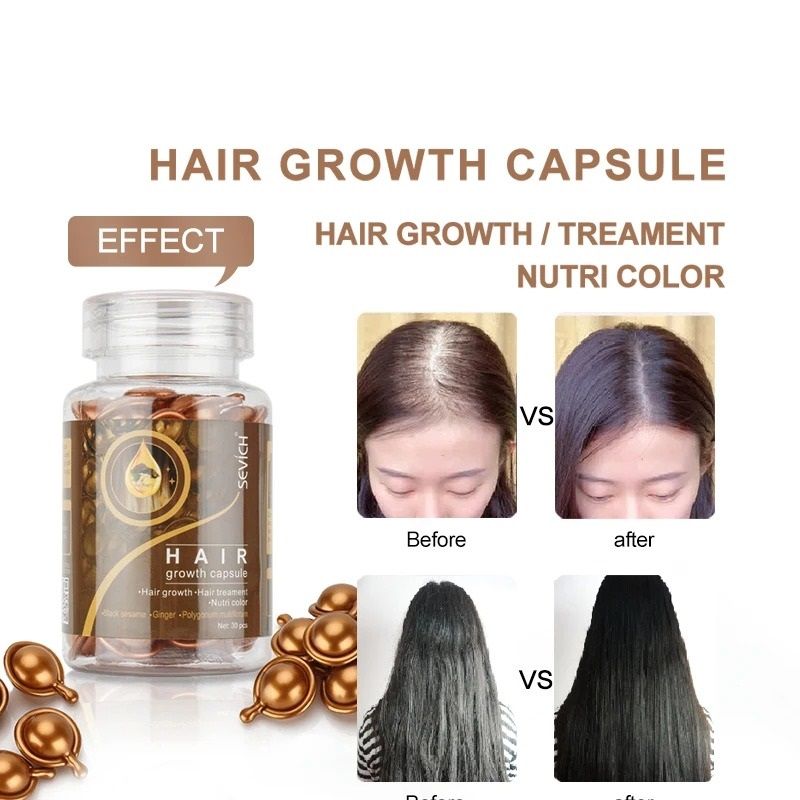 Advanced Polygonum And Ginger Hair Revitalizing Serum Capsules 1