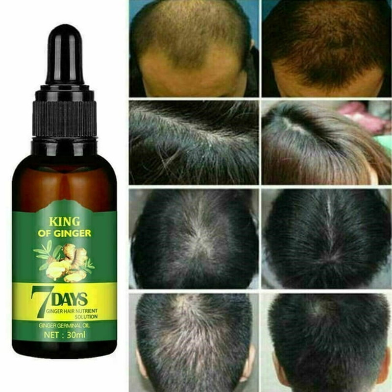 Hair Care Hair Growth Serum for Men Women