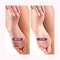 Professional Pedicure Tool for Dead Skin and Calluses