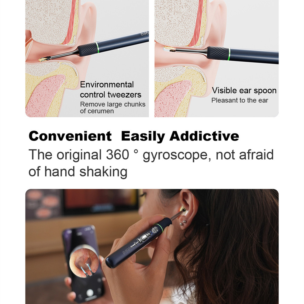 Smart Otoscope Ear Cleaner, Visual Endoscope Tweezers with Mini Camera for Precision Ear Health Care