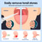 Electric Tonsil Stone Remover Kit, Tonsil Stone Removal Vacuum with LED Light, 3 Suction Modes & Irrigation Syringe